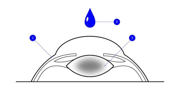Grafik eines Auges mit blauen Tropfen darüber; veranschaulicht Benetzung der Hornhaut durch Tränenflüssigkeit oder Augentropfen.