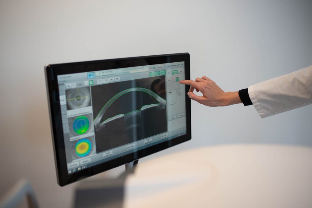Detailaufnahme des CASIA-Geräts für die Analyse des vorderen Augenabschnitts; moderne Diagnosetechnik im Praxisumfeld.