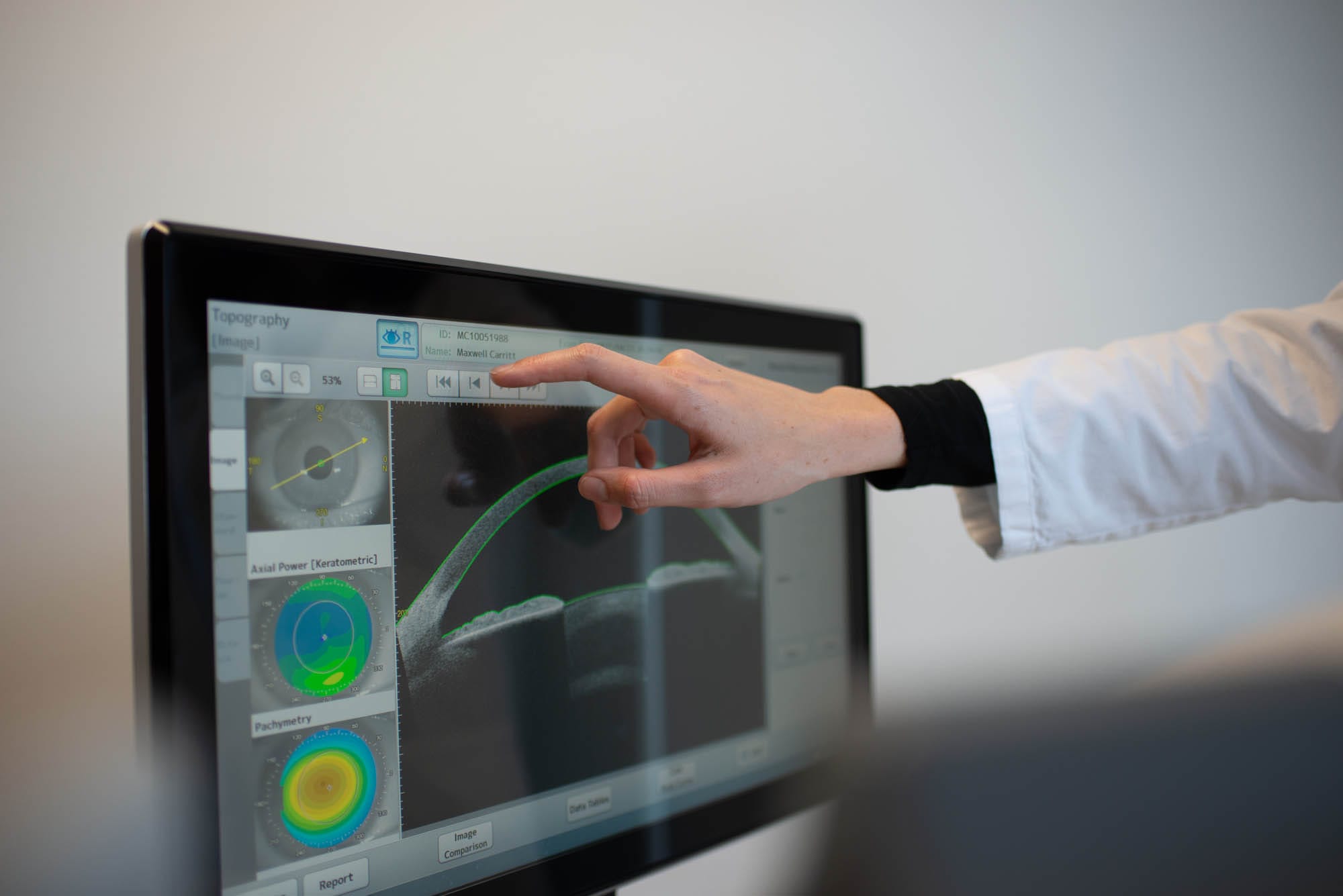 Hand einer Ärztin bedient das CASIA-II-Gerät am Touchscreen; auf dem Monitor sind Messdaten des vorderen Augenabschnitts zu sehen.