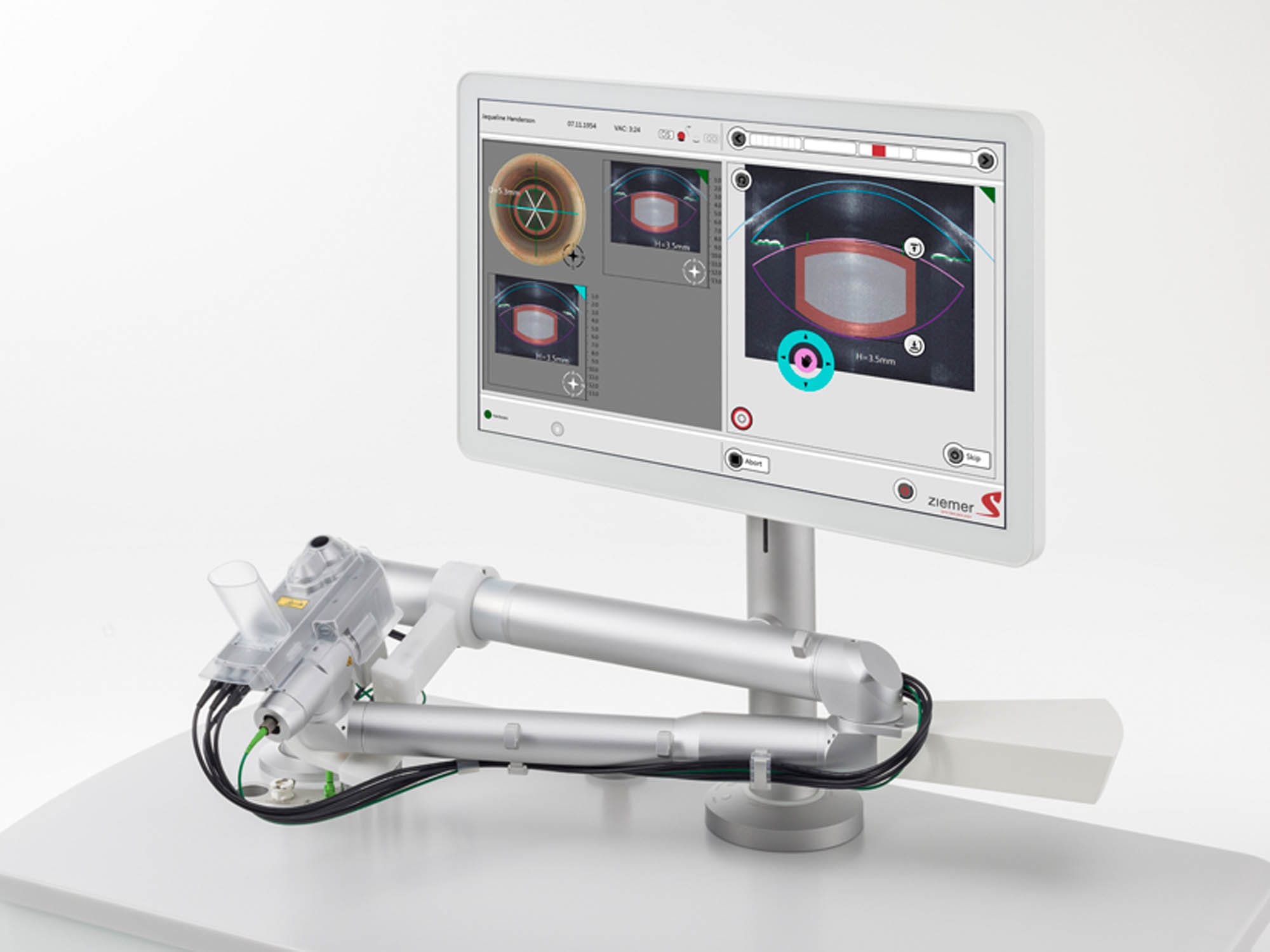 Laser- und Diagnosetechnik für refraktive Chirurgie; Detailaufnahme mit Fokus auf Optik, Bedienelemente und Präzision, zeigt Lasertechnik.