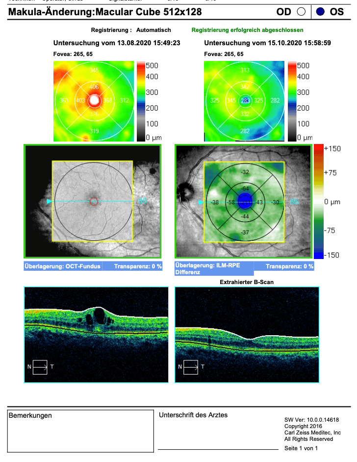 Darstellung einer Netzhaut-Analyse über Zeit, mit Messwerten zu diabetischer Makulopathie und AMD-Verlauf.